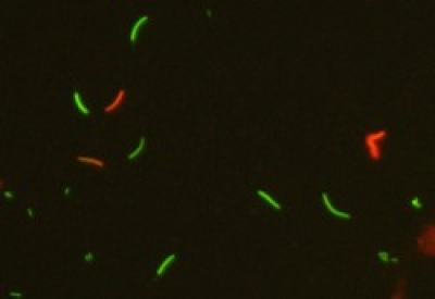 ヤンバルクイナ凍結精子の膜正常性解析の実写真。緑は膜正常、赤は膜異常を示す。